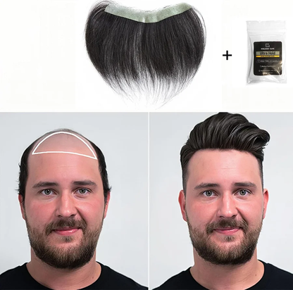 Sugoola® GhostLine Invisible Secret Frontal Hairline System 🇬🇧 100% Natural, Reliable for High    Forehead