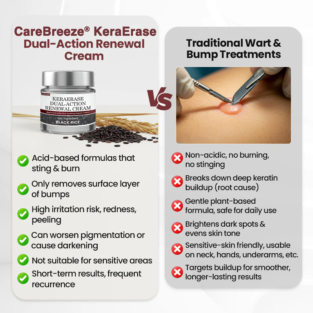 𝗖𝗮𝗿𝗲𝗕𝗿𝗲𝗲𝘇𝗲® 𝗞𝗲𝗿𝗮𝗘𝗿𝗮𝘀𝗲 𝗗𝘂𝗮𝗹-𝗔𝗰𝘁𝗶𝗼𝗻 𝗥𝗲𝗻𝗲𝘄𝗮𝗹 𝗖𝗿𝗲𝗮𝗺 🇬🇧 Made in UK