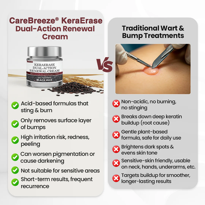 𝗖𝗮𝗿𝗲𝗕𝗿𝗲𝗲𝘇𝗲® 𝗞𝗲𝗿𝗮𝗘𝗿𝗮𝘀𝗲 𝗗𝘂𝗮𝗹-𝗔𝗰𝘁𝗶𝗼𝗻 𝗥𝗲𝗻𝗲𝘄𝗮𝗹 𝗖𝗿𝗲𝗮𝗺 🇬🇧 Made in UK