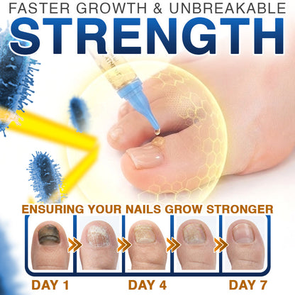 🇬🇧 CareBreeze® Fungi Free Bee Venom Nail Treatment 🌱