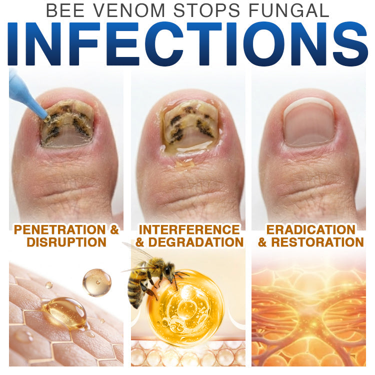 🇬🇧 CareBreeze® Fungi Free Bee Venom Nail Treatment 🌱