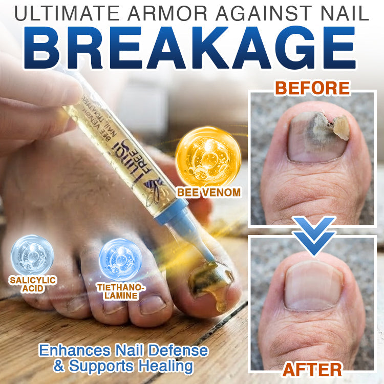 🇬🇧 CareBreeze® Fungi Free Bee Venom Nail Treatment 🌱