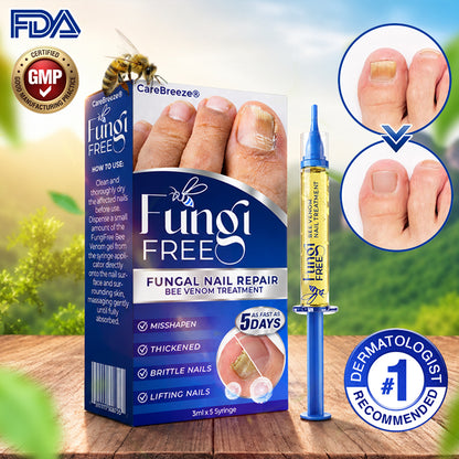 🇬🇧 CareBreeze® Fungi Free Bee Venom Nail Treatment 🐝✨