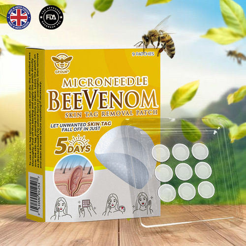 🐝🌿 GFOUK® Bee Venom MicroNeedle Botanic Skin Tag Removal Patch 🇬🇧 Made in the UK