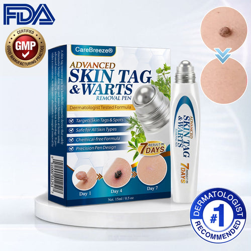 🇬🇧 CareBreeze® Advanced Skin Tag & Wart Removal Roller 🌿