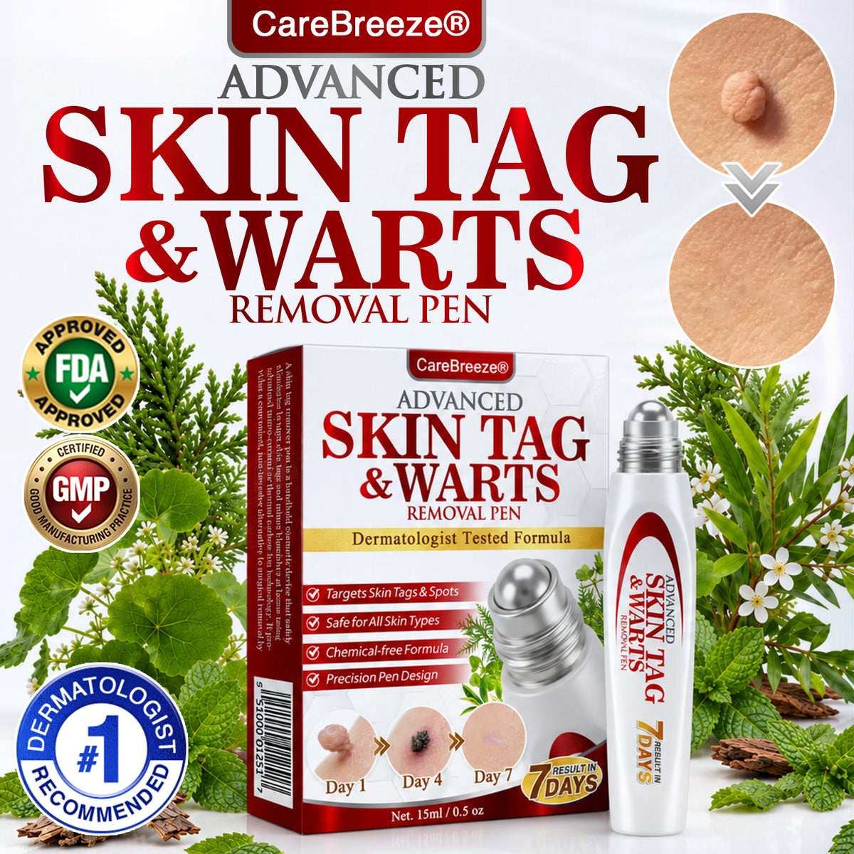 🇬🇧 CareBreeze® Herbal Skin Tag & Wart Removal Roller 👩🏼‍⚕️