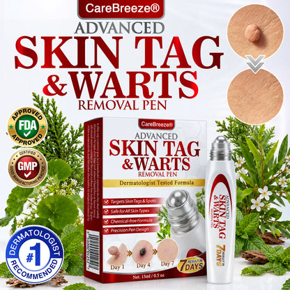 🇬🇧 CareBreeze® Herbal Skin Tag & Wart Removal Roller 👩🏼‍⚕️