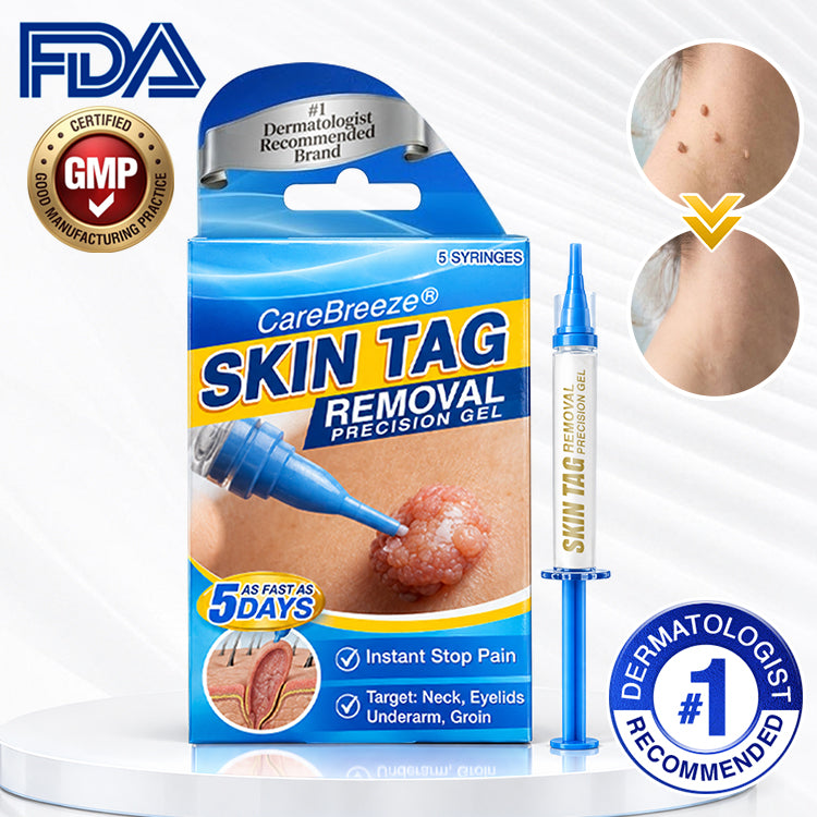 🇬🇧 CareBreeze® Skin Tag Removal Precision Gel 🥼✨