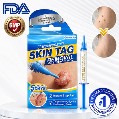 🇬🇧 CareBreeze® Skin Tag Removal Precision Gel 🥼✨