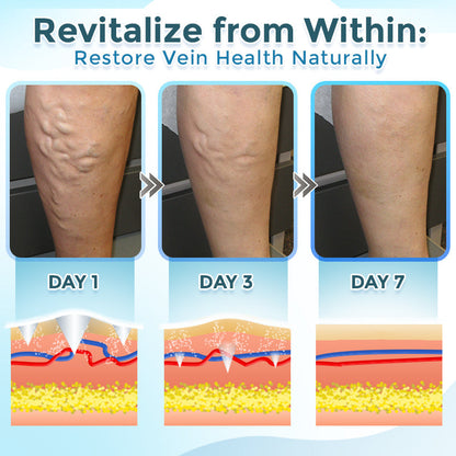 GFOUK® VenaRestore MicroNeedle Vein Repair Patch 🇬🇧