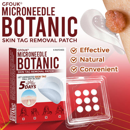 👨‍⚕️🇬🇧 GFOUK® MicroNeedle Botanic Skin Tag Removal Patch 🇬🇧 Aligned with NHS Skincare Guidance