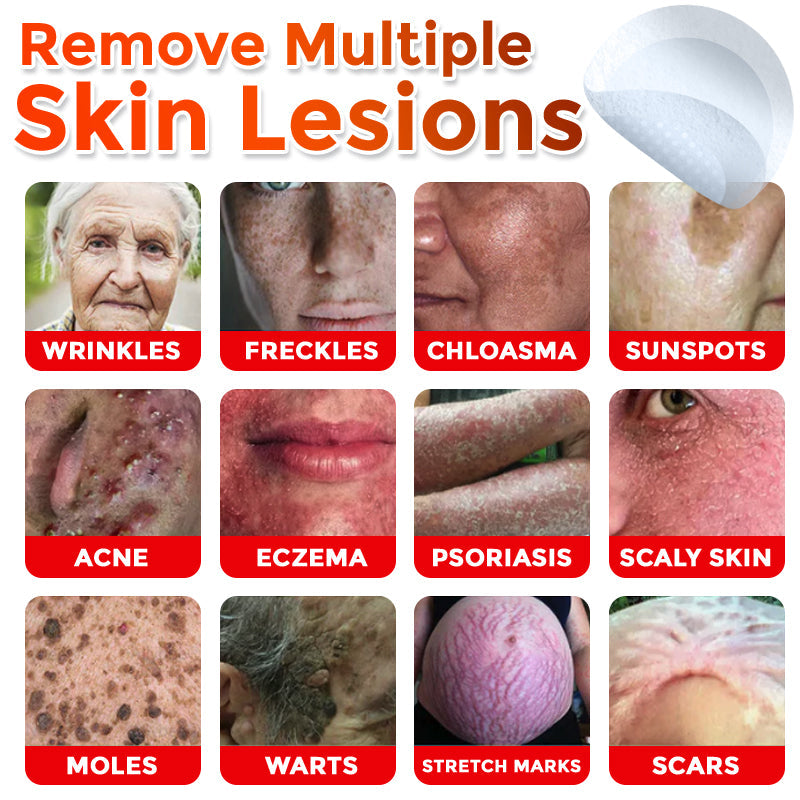 👨‍⚕️🇬🇧 GFOUK® MicroNeedle Botanic Skin Tag Removal Patch 🇬🇧 Aligned with NHS Skincare Guidance