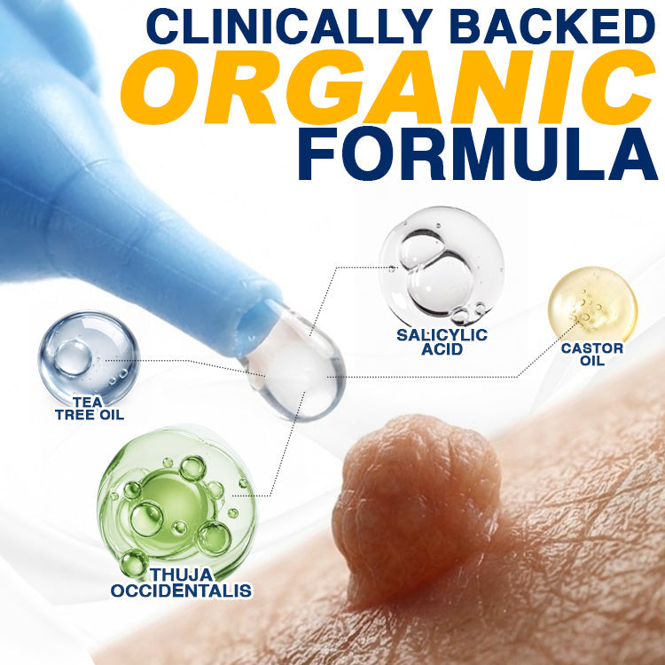 🇬🇧 CareBreeze® Skin Tag Removal Precision Gel 🧑🏻‍⚕️