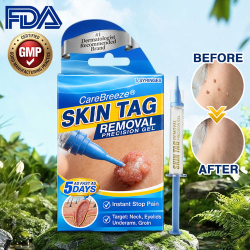 🇬🇧 CareBreeze® Skin Tag Removal Precision Gel 🧑🏻‍⚕️