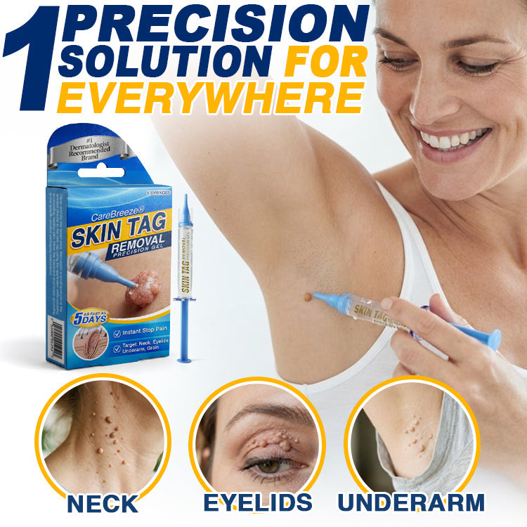 🇬🇧 CareBreeze® Skin Tag Removal Precision Gel 🧑🏻‍⚕️