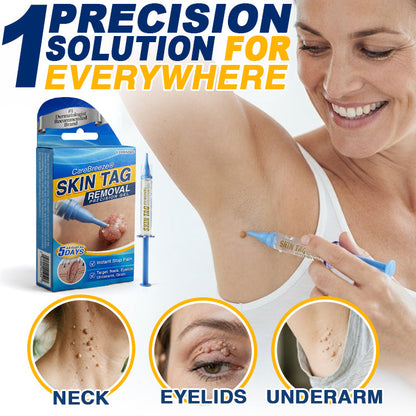 🇬🇧 CareBreeze® Skin Tag Removal Precision Gel 🧑🏻‍⚕️