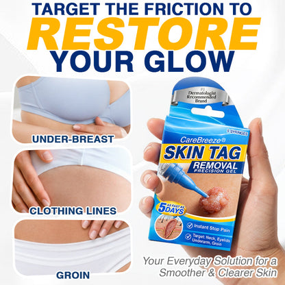 🇬🇧 CareBreeze® Skin Tag Removal Precision Gel 🧑🏻‍⚕️