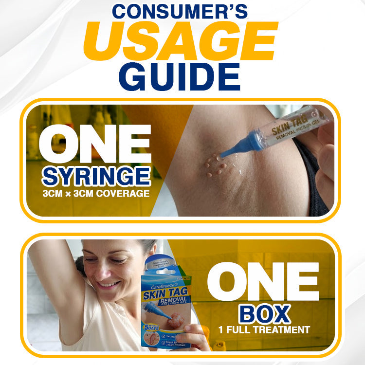 🇬🇧 CareBreeze® Skin Tag Removal Precision Gel 🧑🏻‍⚕️