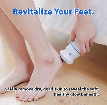Remifa® Vacuum Callus Remover