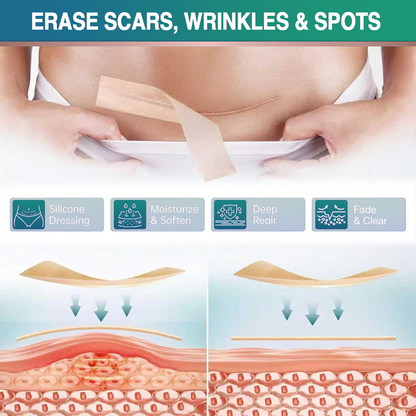 ✅ 𝗖𝗮𝗿𝗲𝗕𝗿𝗲𝗲𝘇𝗲® 3-in-1 Microneedle Care Patch