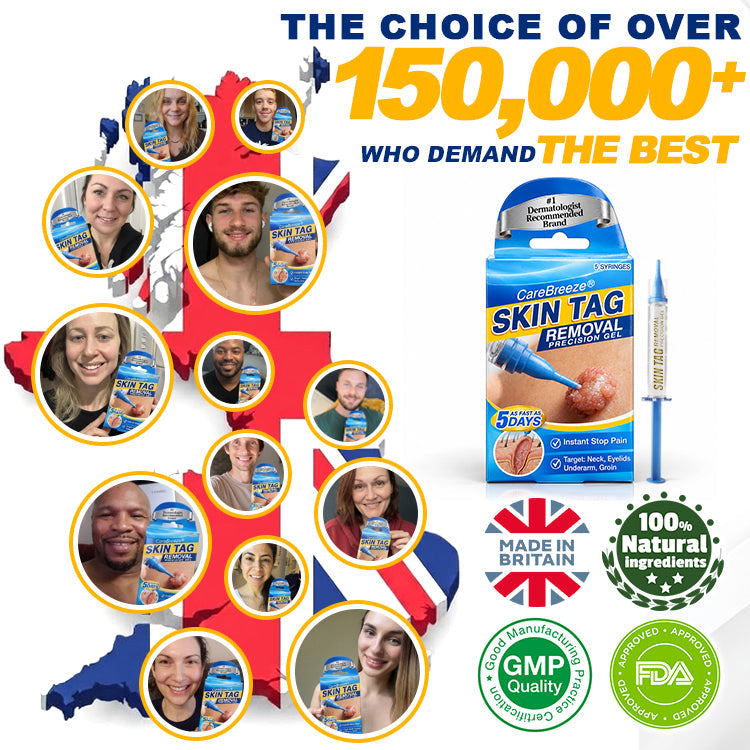 🇬🇧 CareBreeze® Skin Tag Removal Precision Gel 🧑🏻‍⚕️