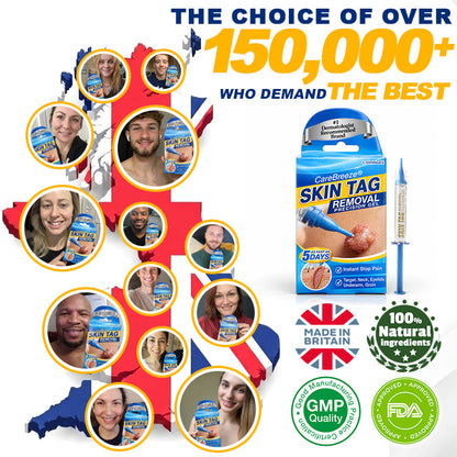 🇬🇧 CareBreeze® Skin Tag Removal Precision Gel 🧑🏻‍⚕️