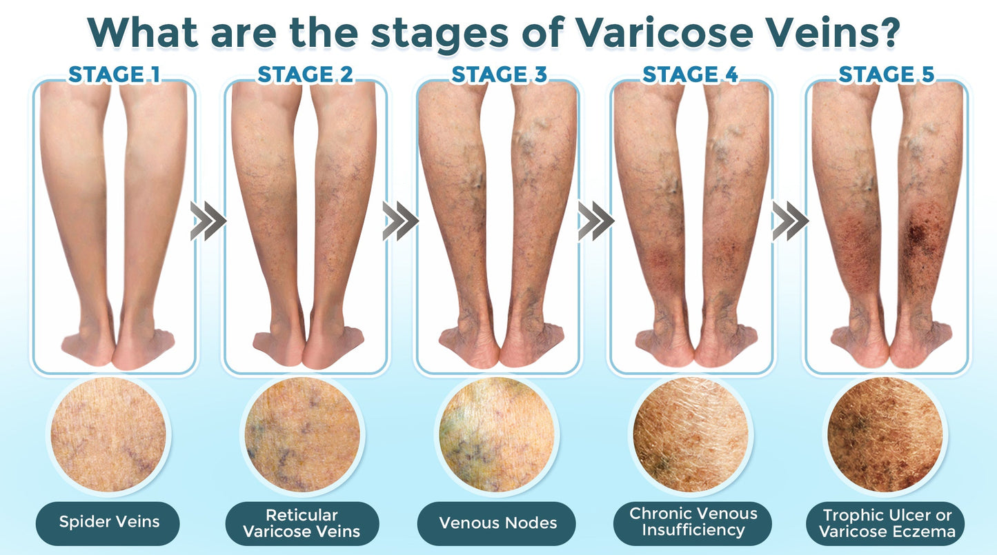 GFOUK® VenaRestore MicroNeedle Vein Repair Patch 🇬🇧