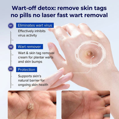 CareBreeze® Advanced Wart & Skin Tag Removal Pen
