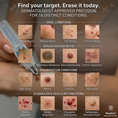 CareBreeze® Advanced Wart & Skin Tag Removal Pen
