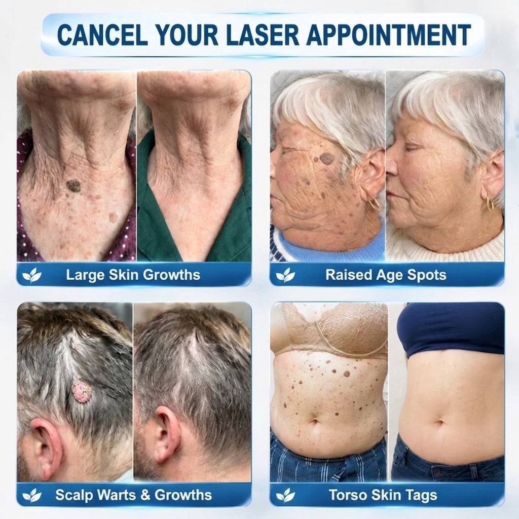 CareBreeze® Advanced Wart & Skin Tag Removal Pen