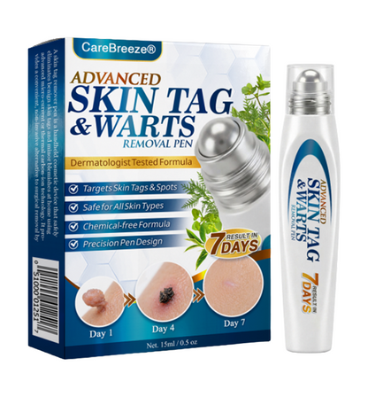 🇬🇧 CareBreeze® Advanced Skin Tag & Wart Removal Roller 🌿