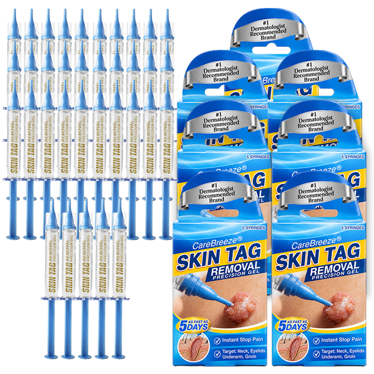 🇬🇧 CareBreeze® Skin Tag Removal Precision Gel 🥼✨